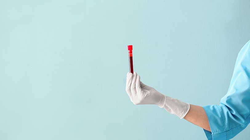 How Long Does Alcohol Stay In Your Blood?